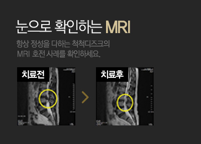 눈으로 확인하는 MRI