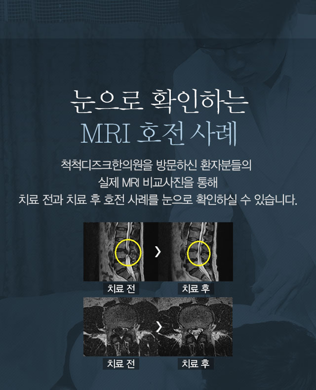 mri호전사례